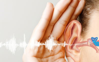 Neuropatía auditiva
