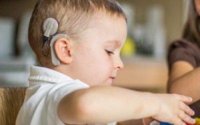 El implante coclear y el desarrollo psicofísico